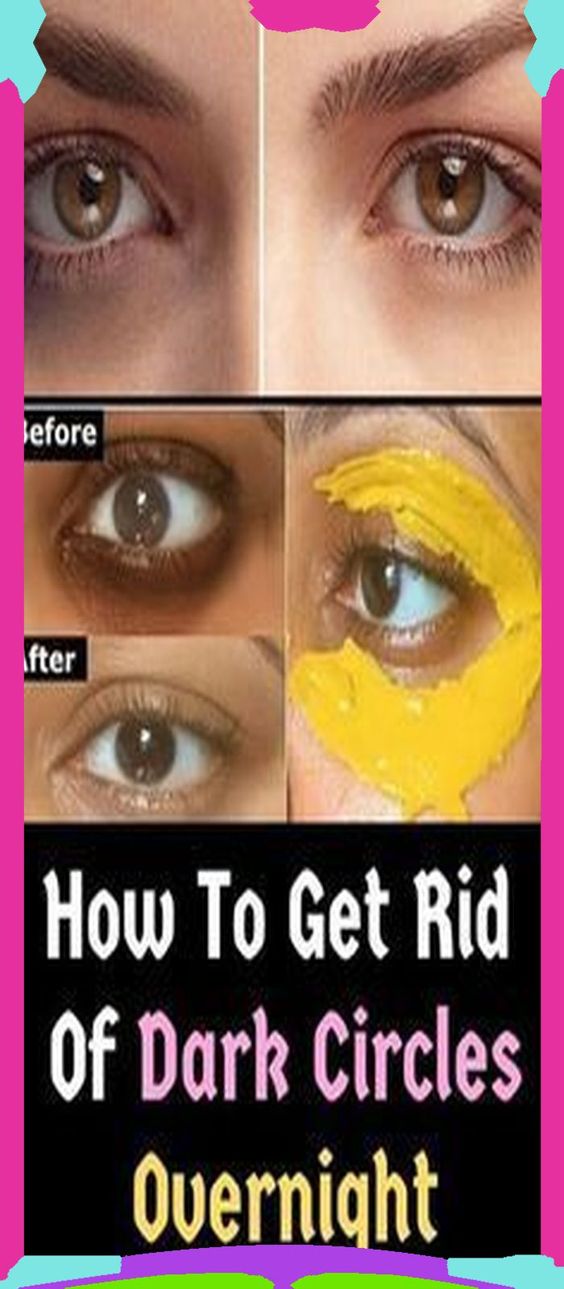 BAKING SODA MASK AGAINST EYE BAGS, DARK CIRCLES AND SWOLLEN EYELIDS
