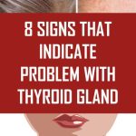 8 SIGNS THAT INDICATE PROBLEM WITH THYROID GLAND